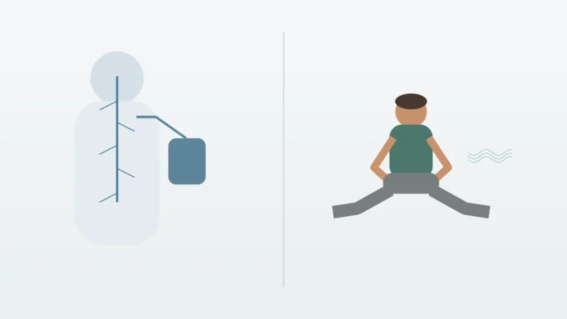 Vagus Nerve Stimulation vs. Vagus Nerve Exercises: What’s the Difference?